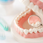 虫歯治療イメージ